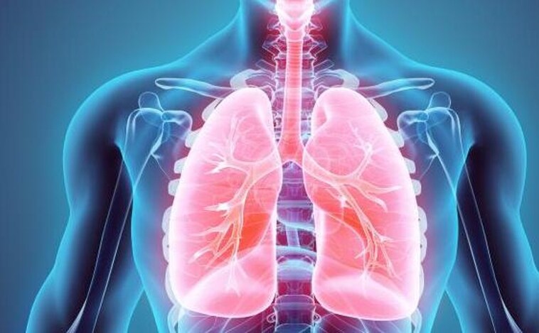 El edema pulmonar es una afección respiratoria que puede producirse por el mal de altura