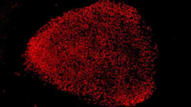 La edición de genes CRISPR corrige una mutación que causa ceguera