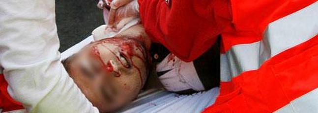 «Tuvo muy mala suerte: lo enganchó en el suelo después de haberse caído»