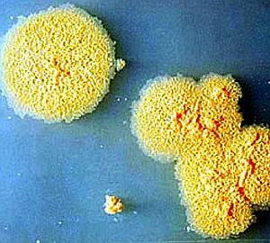 Esta bacteria nos hará más inteligentes