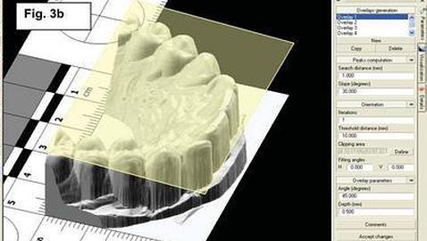 El cadáver identificado por sus dientes