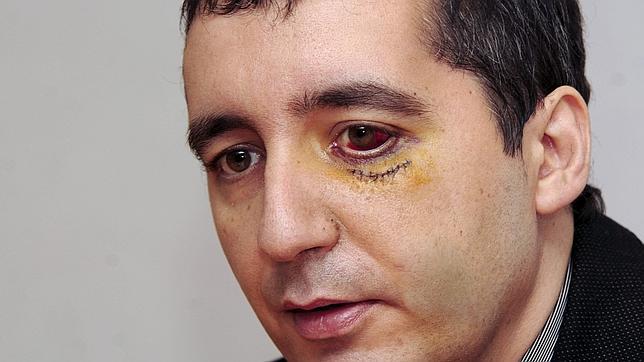 El consejero de Murcia agredido lamenta que existan «reductos radicales»