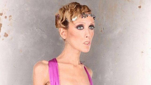 Se cuadriplican los sitios web que fomentan la anorexia