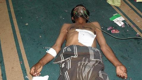 Quince manifestantes muertos por disparos de la Policía en Yemen