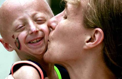 La enfermedad que hizo viejos de niños a Néstor y Guillermo