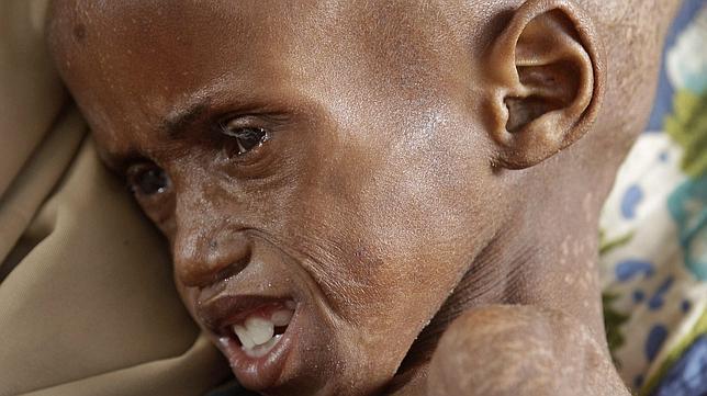 Somalia se muere de hambre