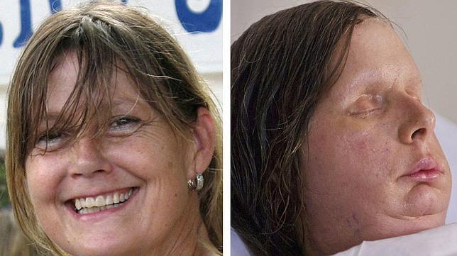 Publican las imágenes del nuevo rostro de la mujer atacada por un chimpancé