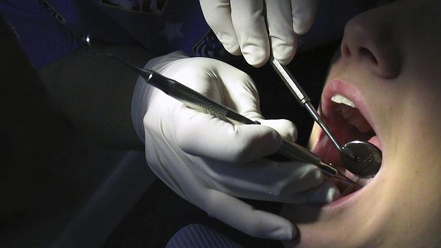 La limpieza dental disminuye el riesgo de sufrir un ataque al corazón