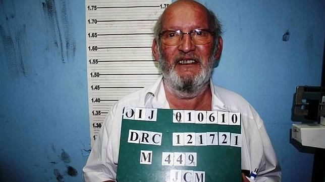 Los implantes mamarios defectuosos también se vendieron en Holanda