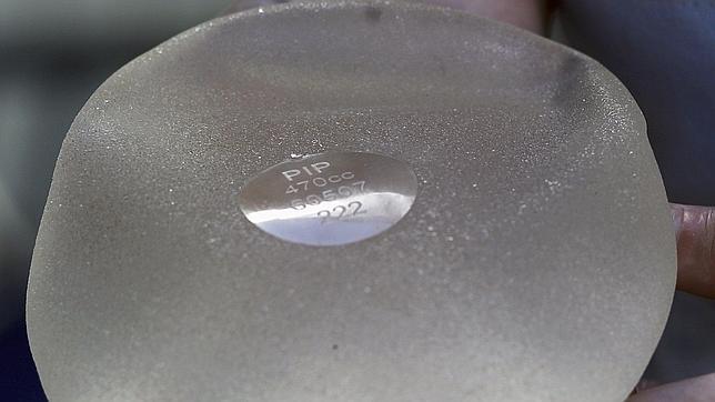 Los cirujanos plásticos españoles aconsejan ahora la retirada preventiva de las PIP