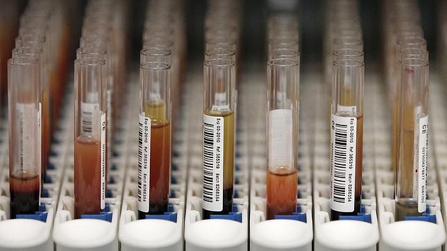 «Se ha llegado a tardar hasta 25 años en diagnosticar una enfermedad rara»