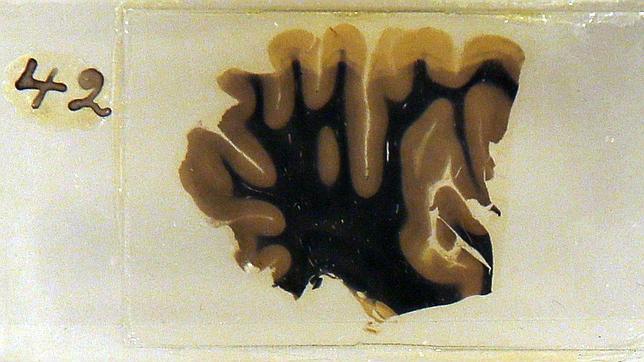 Los secretos del cerebro de Einstein, al descubierto