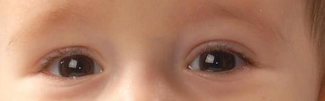 Fernando, un bebé de nueve meses, busca con urgencia un trasplante de médula