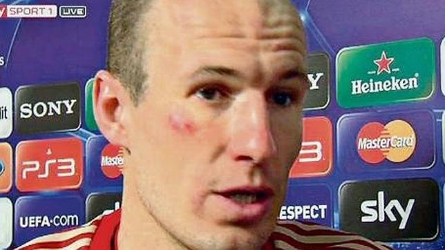 Ribéry y Robben, pelea en el descanso del Bayern-Real Madrid
