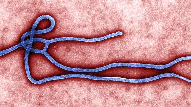 El ébola causa al menos 14 muertos en Uganda