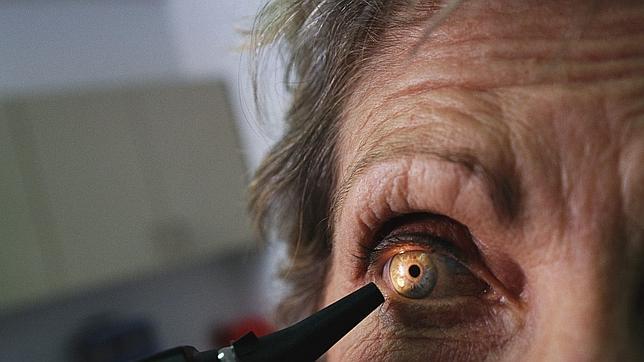 Los operados de cataratas tienen menos riesgo de fractura de cadera