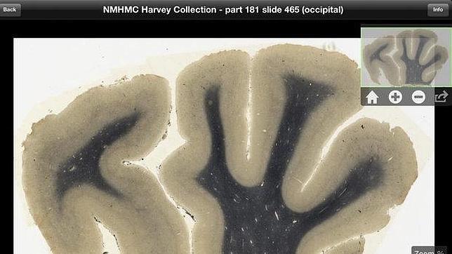 El cerebro de Einstein también tiene una aplicación para el iPad