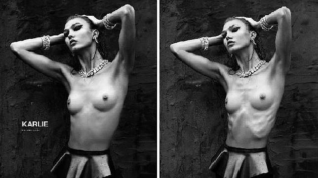 La modelo Karlie Kloss, retocada para ocultar su extrema delgadez