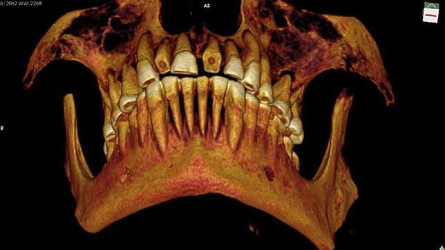 La momia murió de caries