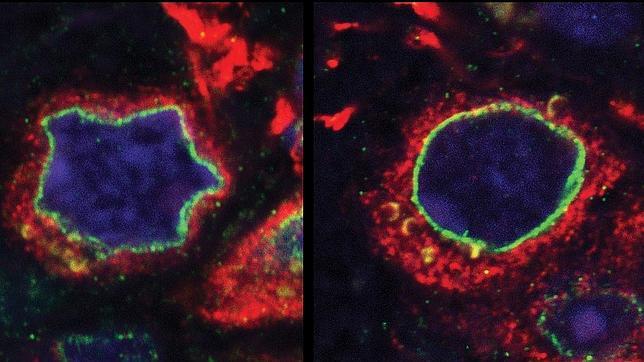 Hallan las células madre que provocan la pérdida de neuronas en el párkinson
