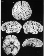 El cerebro de Einstein sí era diferente