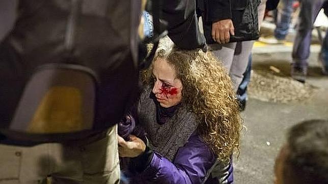 Familia y amigos de la mujer herida en el ojo en Barcelona van a depurar responsabilidades