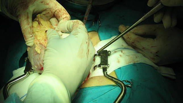 Cada paciente trasplantado de riñón ahorra una media de 21.000 euros a la sanidad pública