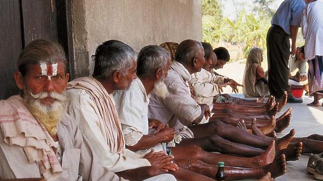 La lepra se salda con 219.000 nuevos casos cada año