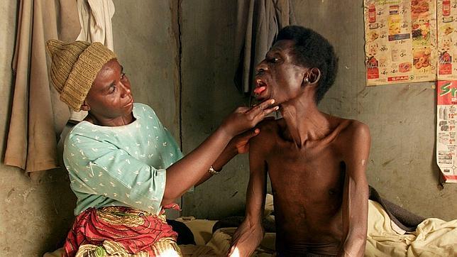 Enfermedades del «primer mundo», pacientes del «tercero»