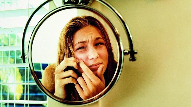 ¿Por qué yo tengo acné y tú no?