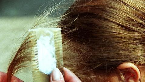 Un producto natural contra los piojos