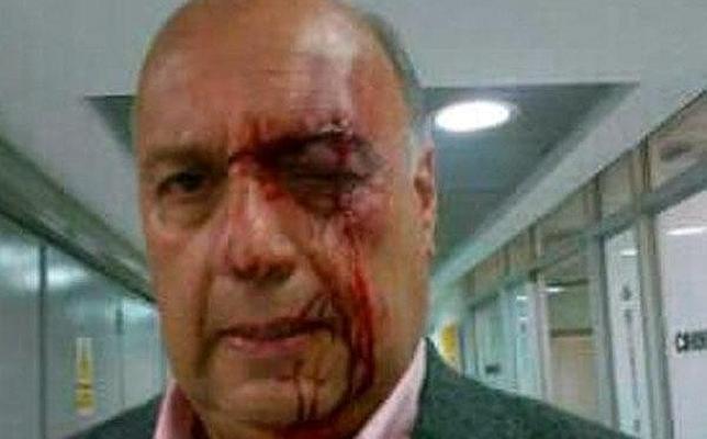 Chavistas agreden brutalmente a dos diputados opositores en el Parlamento venezolano