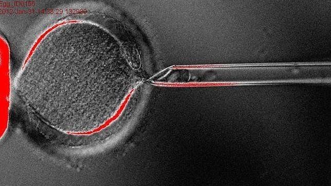 «Éticamente es inaceptable, su fin es matar embriones en fase temprana»