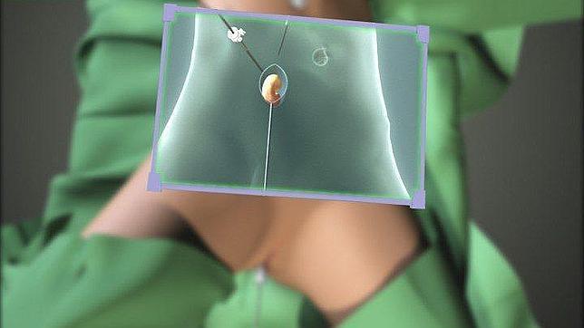 Operación quirúrgica