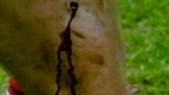 Así quedó la pierna de Julen Guerrero tras el pisotón de Diego Pablo Simeone