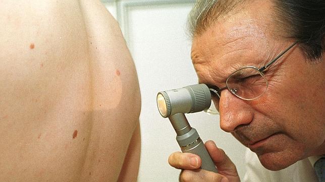 Un doctor examinando un lunar