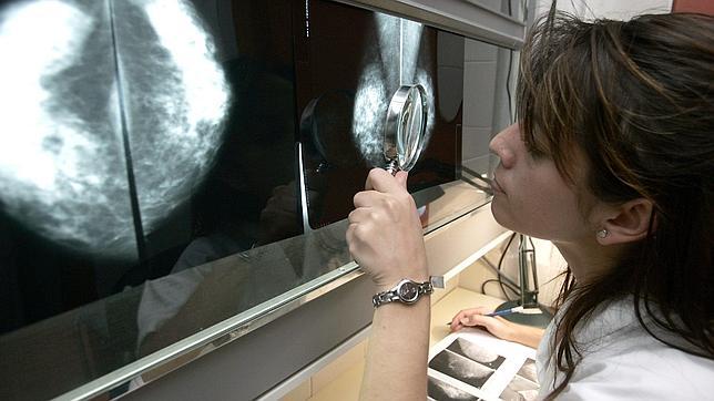 Cáncer de mama. Un paso más adelante