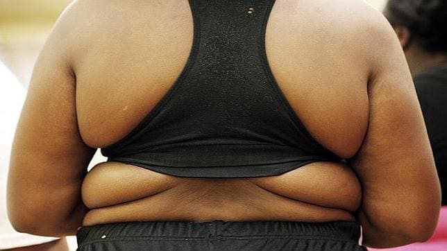 La hormona que regula el apetito deja de funcionar en las personas con obesidad