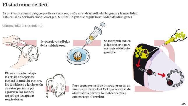 Una terapia génica corrige los síntomas del síndrome de Rett
