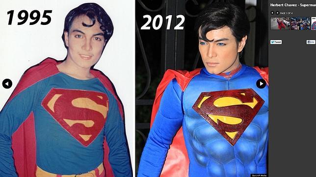 Un joven se gasta 5.200 € en trece cirugías para parecerse a su héroe, Superman