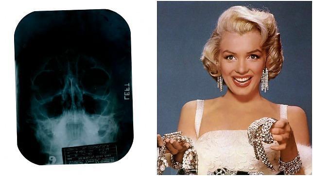 Marilyn Monroe se sometió a cirugía plástica de nariz y barbilla