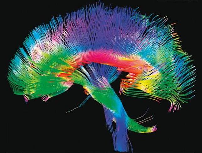 El cerebro humano trabaja al borde de la locura