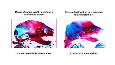 Diferencias en el desarrollo del cerebro de ratones cuyos progenitores seguían una dieta rica en folatos (izda) o pobre (dcha).
