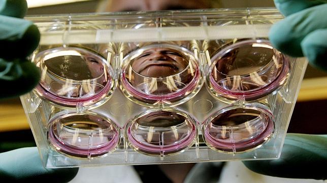 Cultivo de células madre