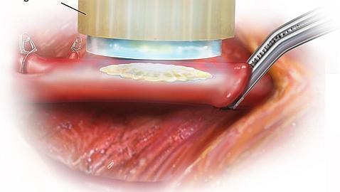 Gracias a un haz de luz el pegamento se adhiere al vaso