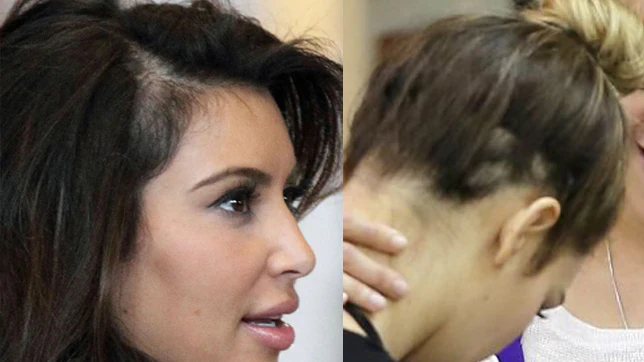 Kim Kardashian se está quedando calva