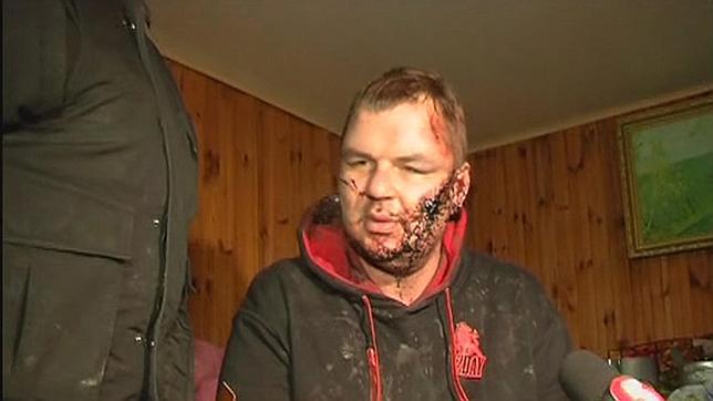 El opositor secuestrado y torturado en Ucrania viaja a Letonia para ser atendido