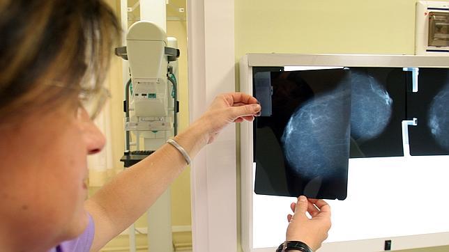 La detección precoz mejora el pronóstico