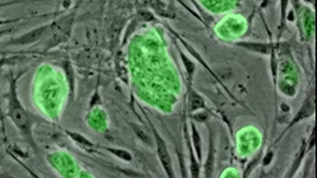 Células reprogramadas de la piel logran curar la diabetes tipo 1 en ratones