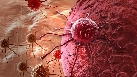 Tratar el cáncer de colon «matando de hambre» a las células tumorales